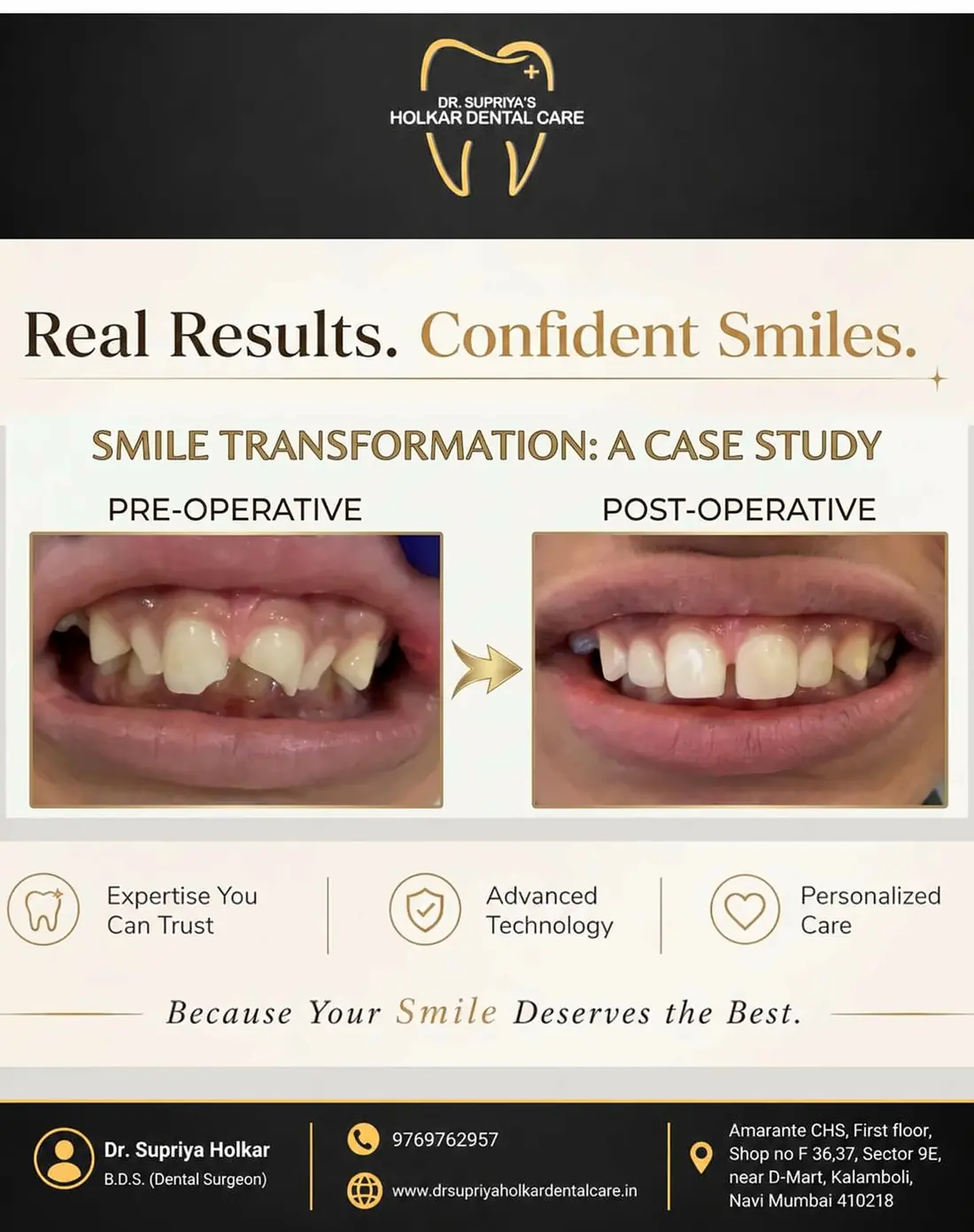 Smile transformation case study showing a patient before and after treatment