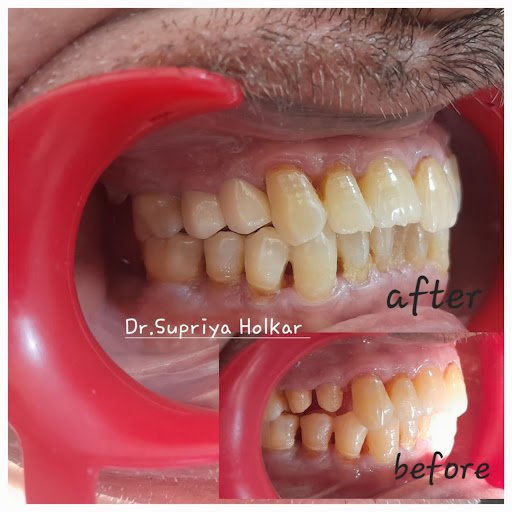 Photo from customer review